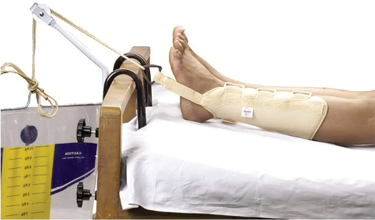 Dyna Ankle Traction (M) 1